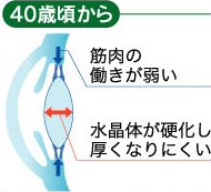 老眼（老視）はこうして起こります