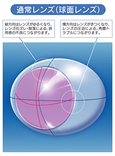 角膜形状に合わせたオーダーメイド※で快適な「つけ心地」