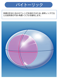 角膜形状に合わせたオーダーメイド※で快適な「つけ心地」