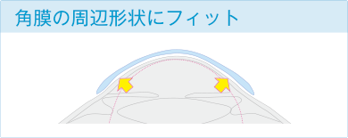 角膜の周辺形状にフィット